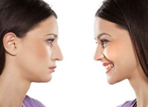 female face, before and after cosmetic nose surgery